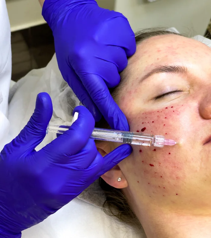 Image hover effect image