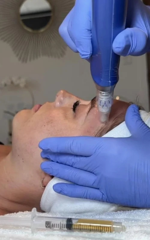 Skin and hair Treatment