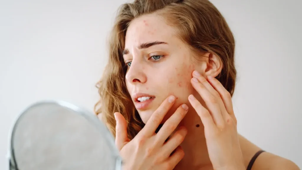 Skin Treatments in Surat