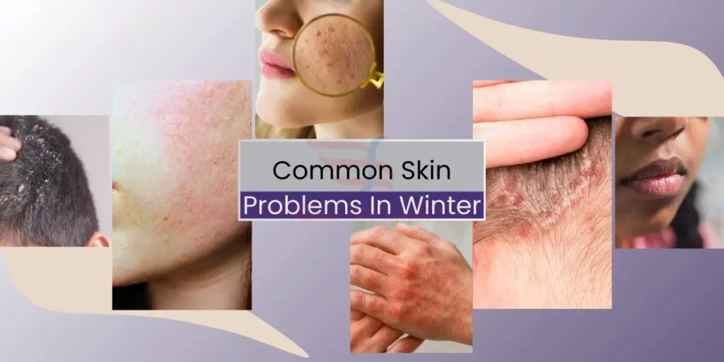 Skin Treatments in Surat