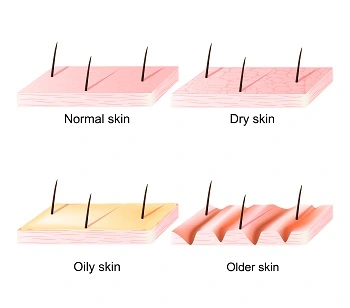 Skin Treatments in Surat