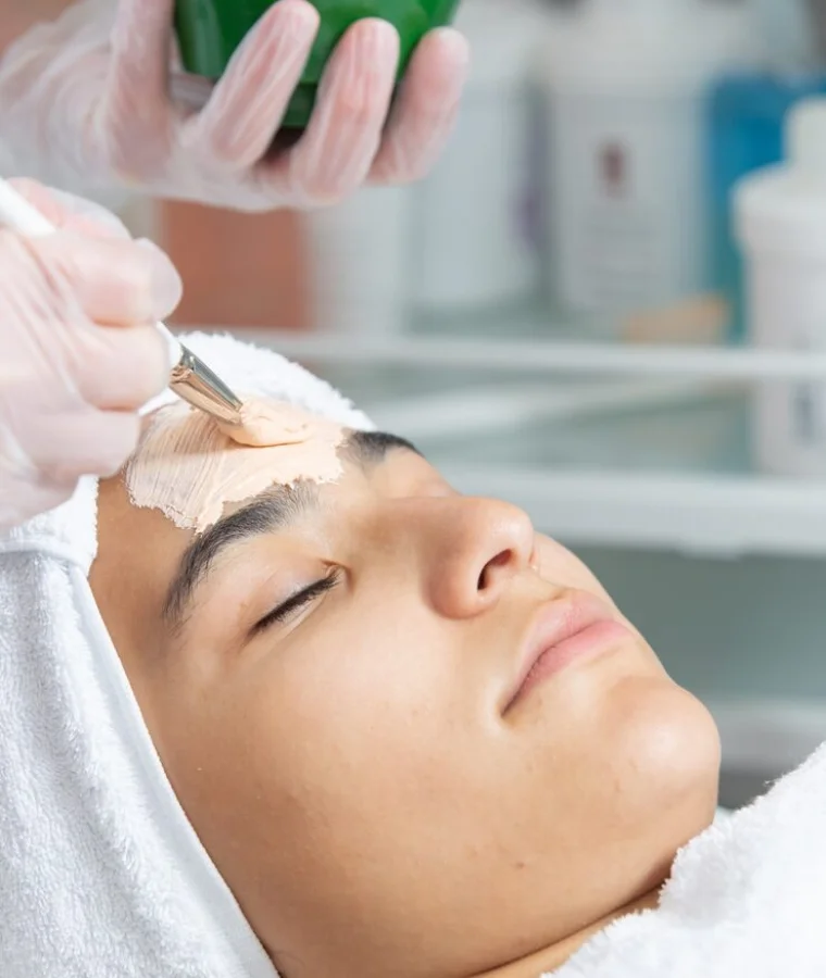 Light Chemical Peel