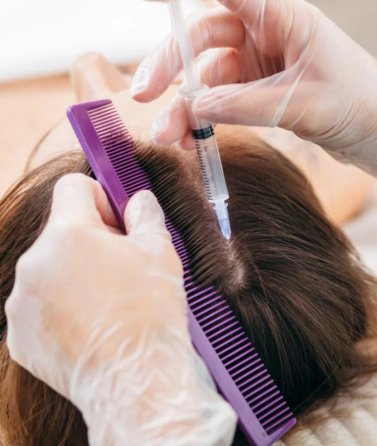 PRP Hair Treatment