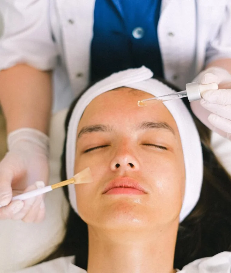 Chemicals Peel for Pigmentation