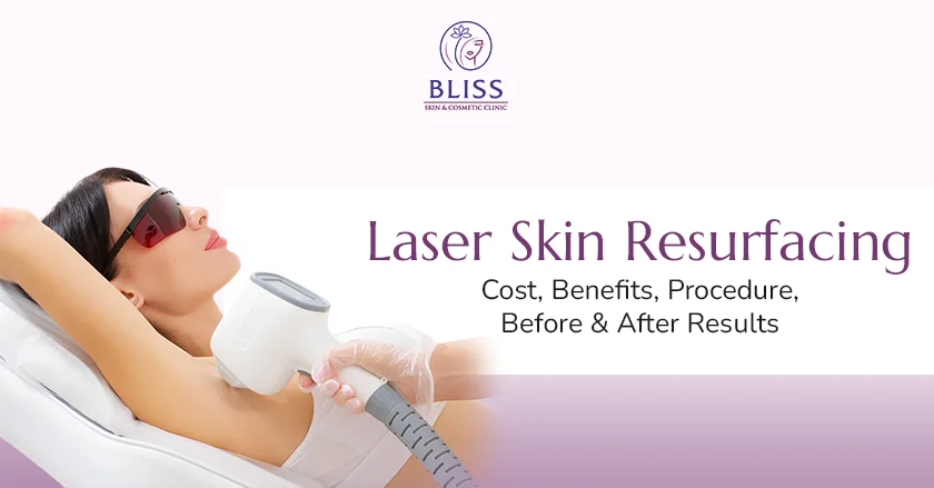 Laser Skin Resurfacing Cost, Benefits, Procedure, Before & After Results