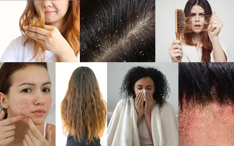 Common Skin & Hair Concerns